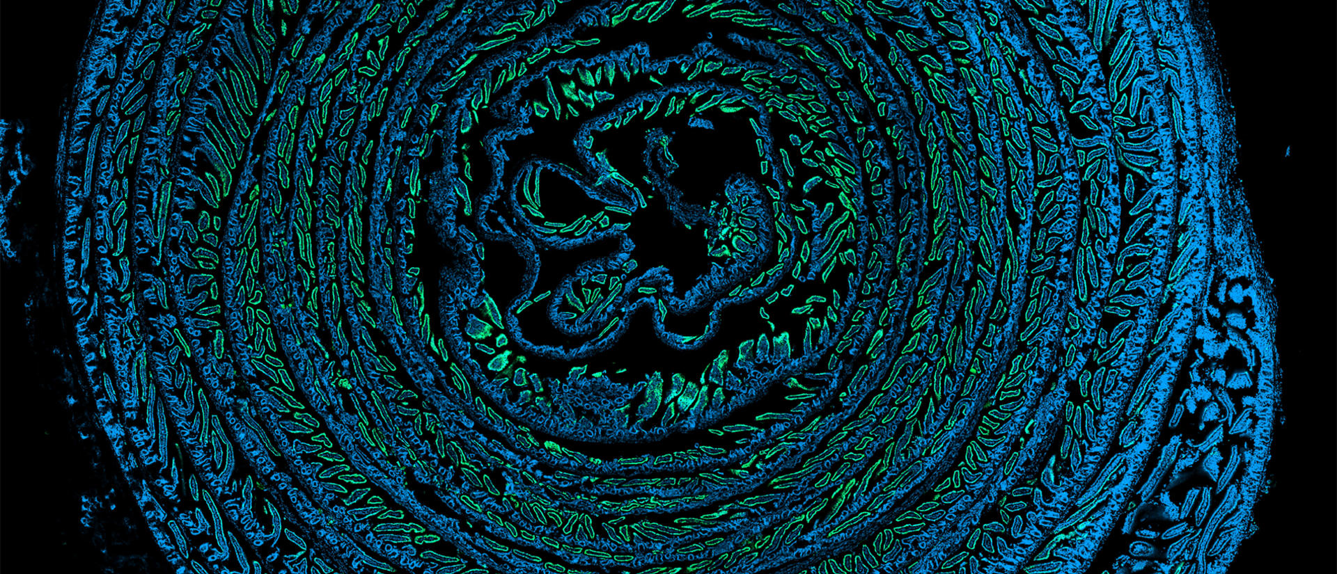 Guangqing Lu Ileum with GFP reporter
